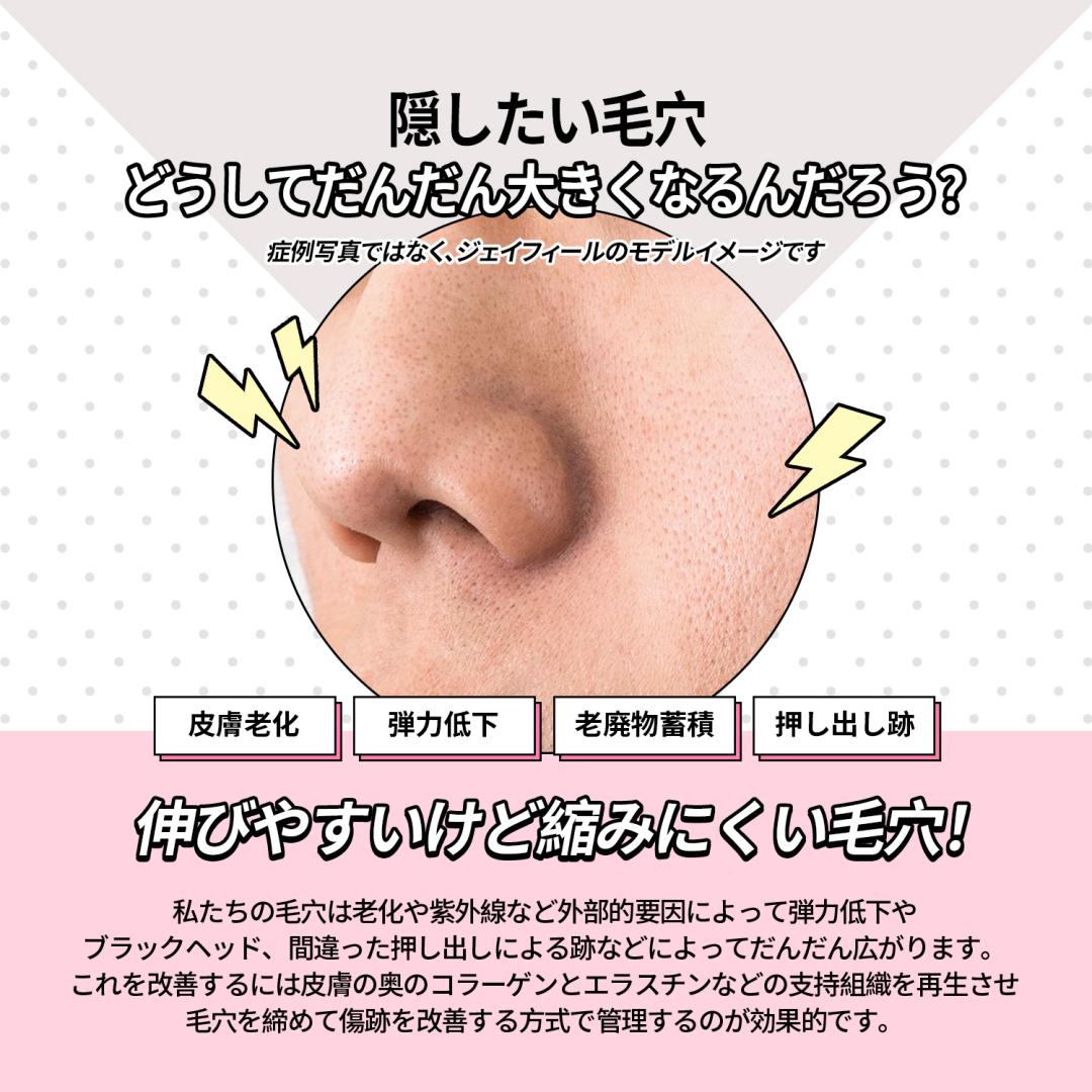 毛穴撃退、ピコフラクセル