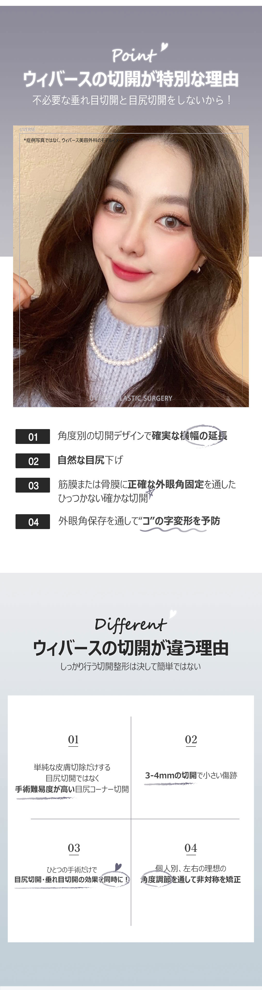ウィバース 目尻コーナー切開