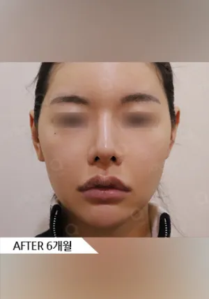 After