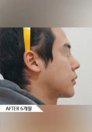 After