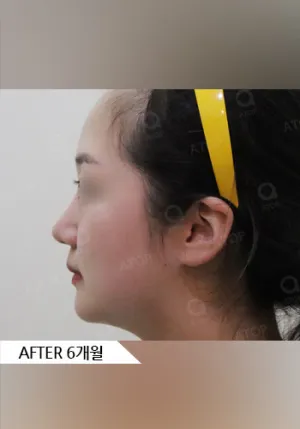 After