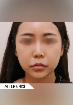After