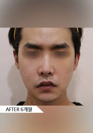 After