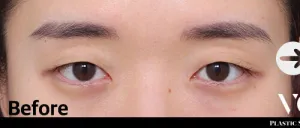 Before