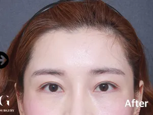 After
