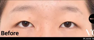 Before