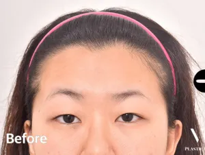 Before