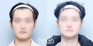 After