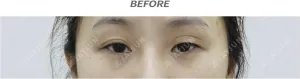 Before