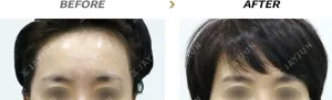 Before