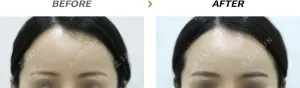 Before