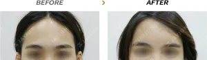 Before