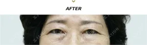 After