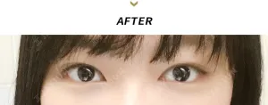 After