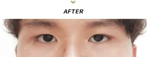 After