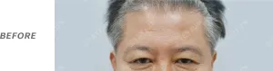 Before