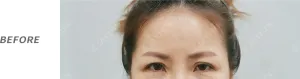Before