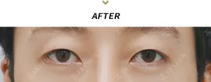 After