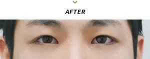 After