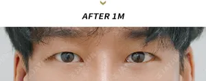 After