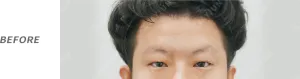 Before