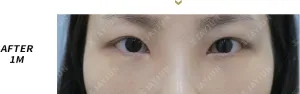 After