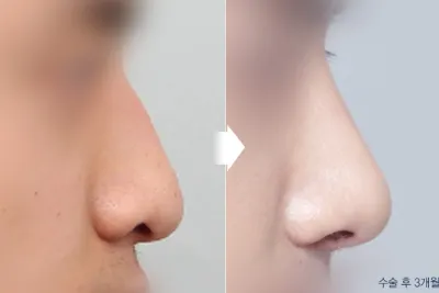 Before & After