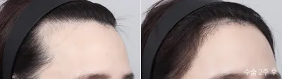 Before & After