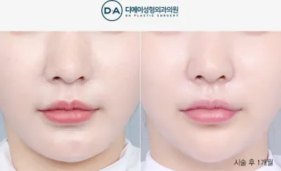 Before & After