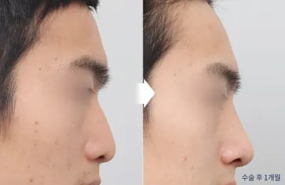 Before & After
