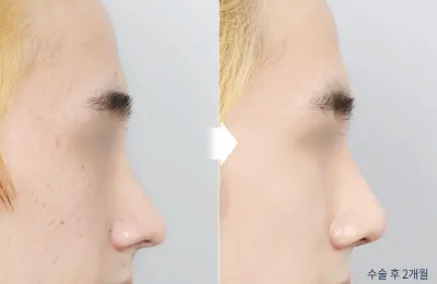 Before & After