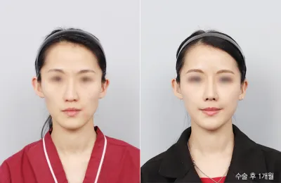 Before & After