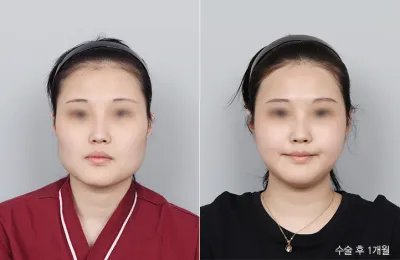 Before & After