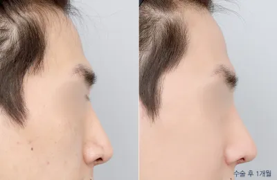 Before & After