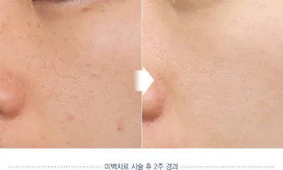 Before & After