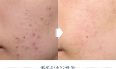 Before & After