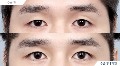 Before & After