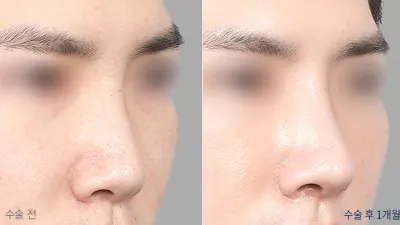 Before & After
