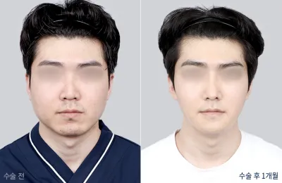 Before & After