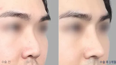 Before & After