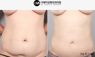 Before & After