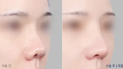 Before & After