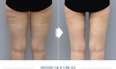 Before & After