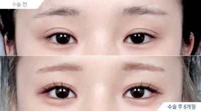 Before & After
