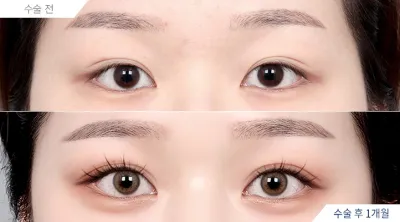 Before & After