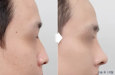 Before & After