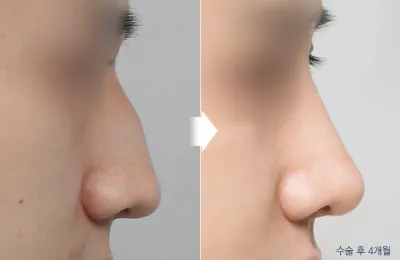 Before & After