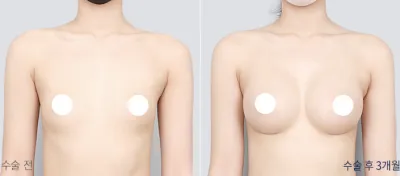 Before & After