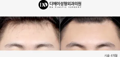 Before & After