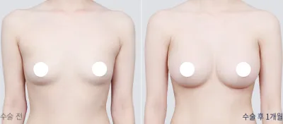 Before & After